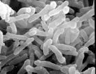Baktérie, ktoré spôsobujú vznik akné